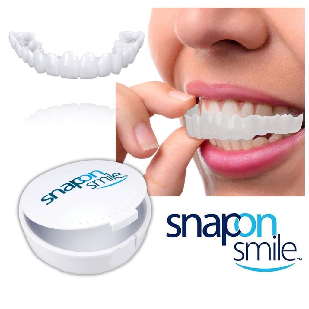 Snap-On Smile